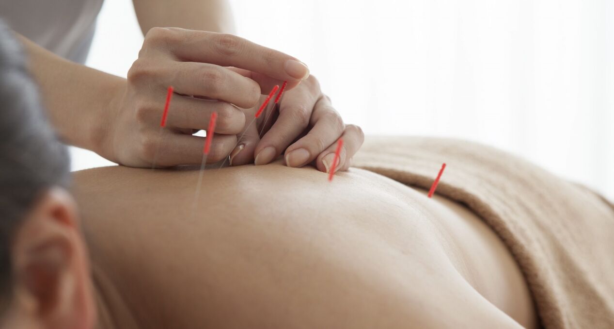 akupunkturë për të rritur fuqinë